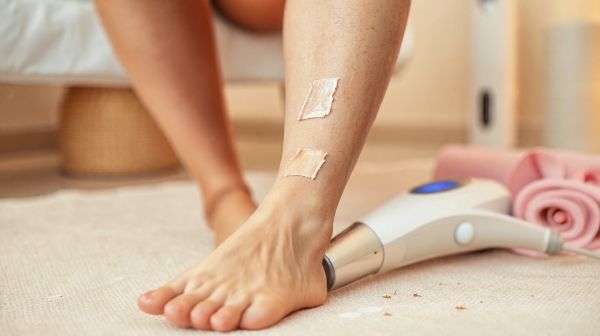 Les meilleures astuces pour une épilation laser efficace à Lyon